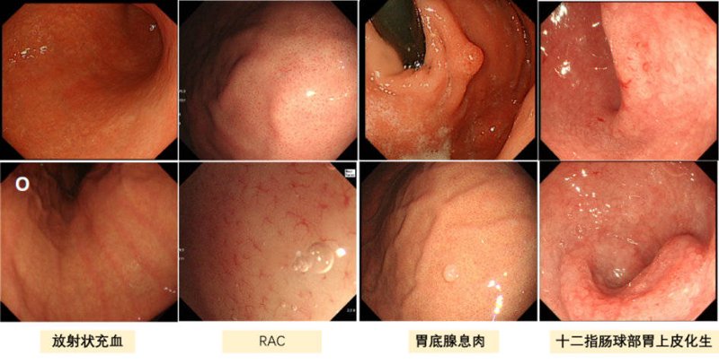 南京腋臭专科医院