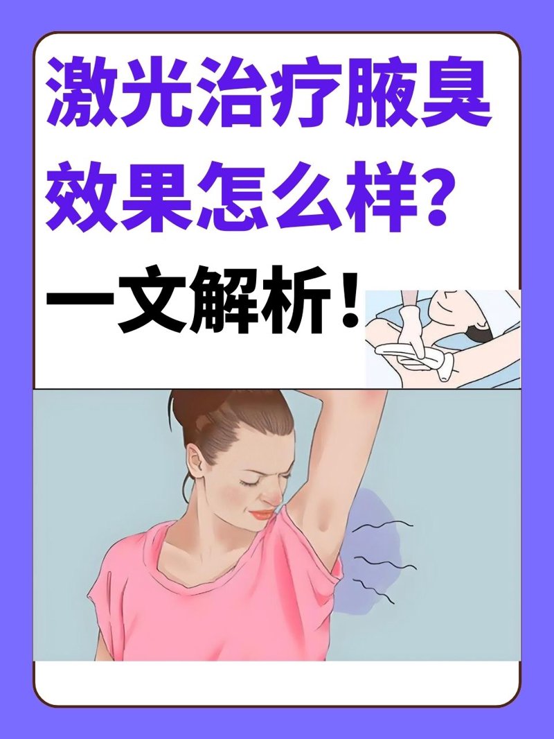 激光治疗腋臭效果怎么样?一文解析!